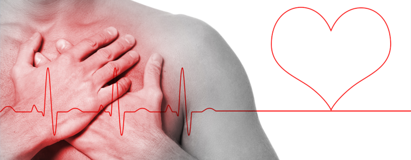 Eletrocardiograma